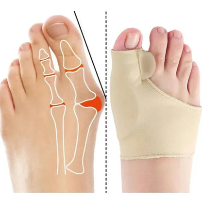 Corrector Ortopédico de Juanetes Leenah™ - ¡Lleva 2 por 1!