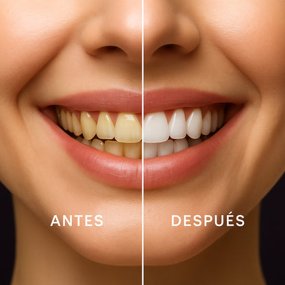 Pure Glow™ - Blanqueador Dental